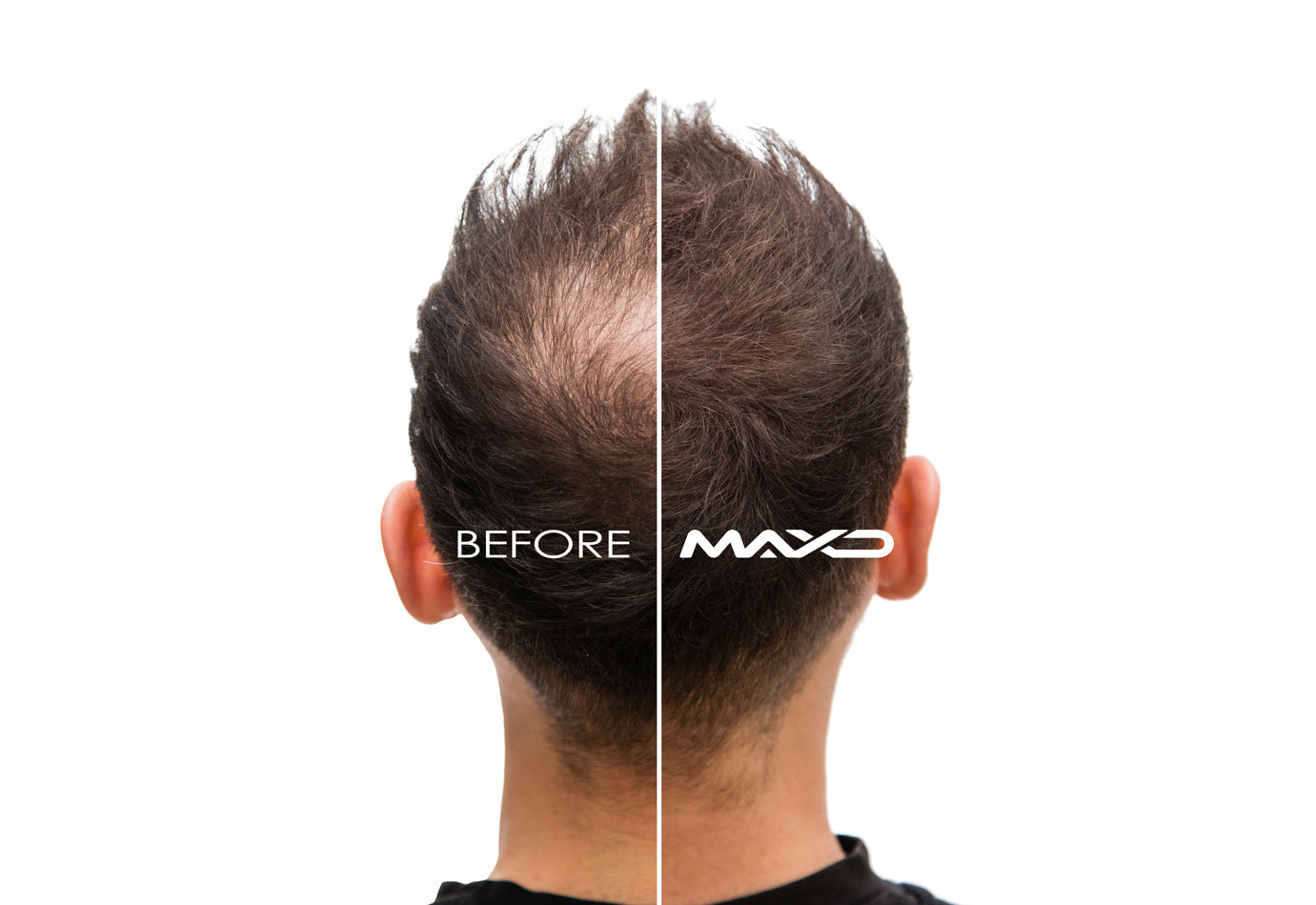 MAXD Hair Thickening Fibers